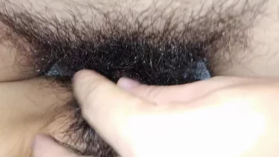 桐乡多毛妊娠纹少妇